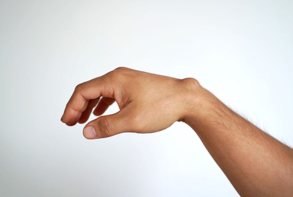 Accueil kyste synovial au poignet